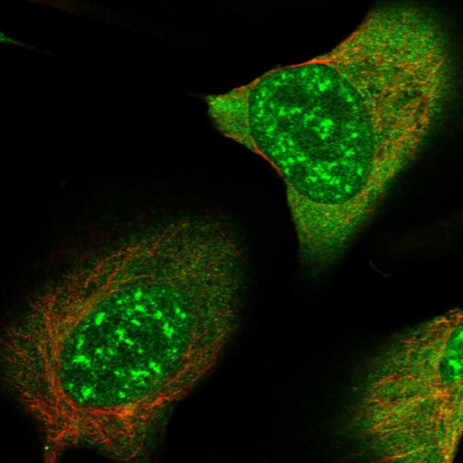 SMC4 Antibody in Immunocytochemistry (ICC/IF)