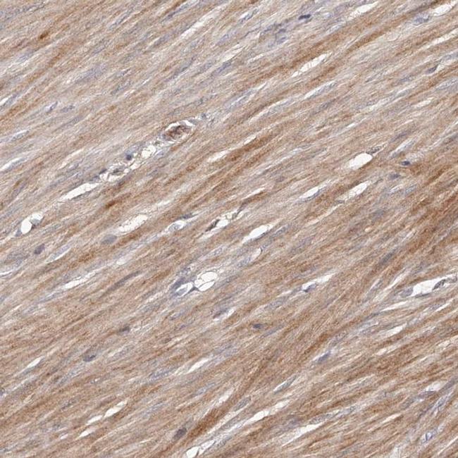 URG4 Antibody in Immunohistochemistry (IHC)