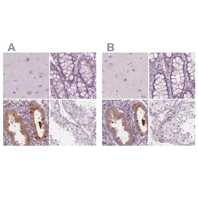 PAEP Antibody in Immunohistochemistry (IHC)