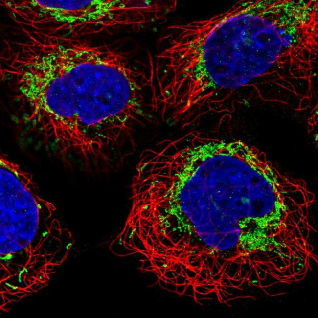 MACC1 Antibody in Immunocytochemistry (ICC/IF)