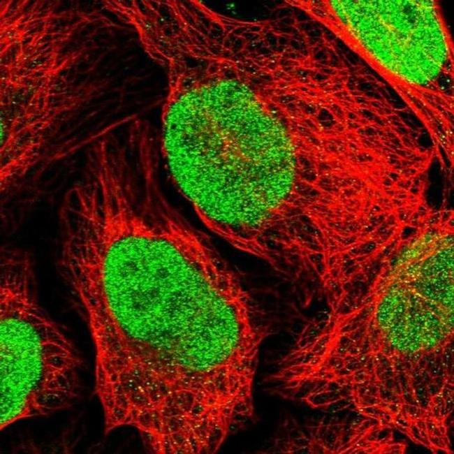 Transketolase Antibody in Immunocytochemistry (ICC/IF)