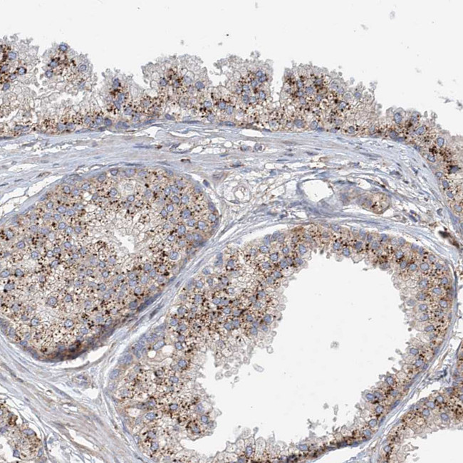 HGSNAT Antibody in Immunohistochemistry (Paraffin) (IHC (P))