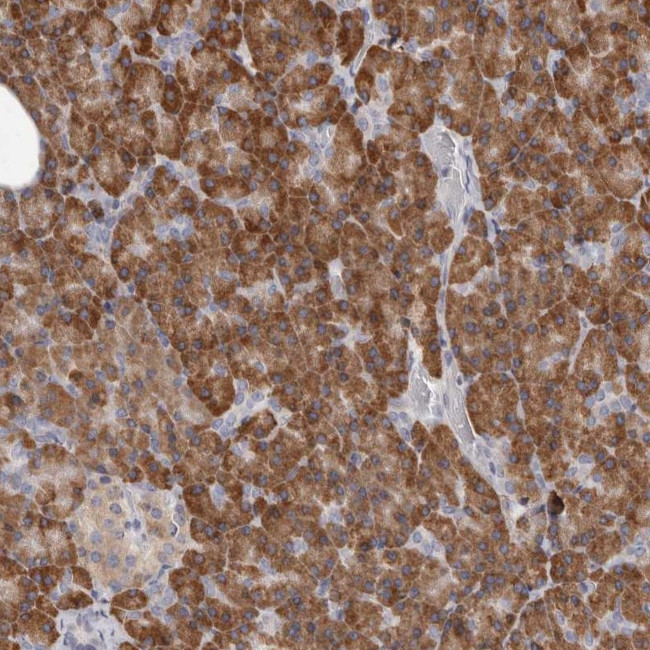 QRSL1 Antibody in Immunohistochemistry (Paraffin) (IHC (P))