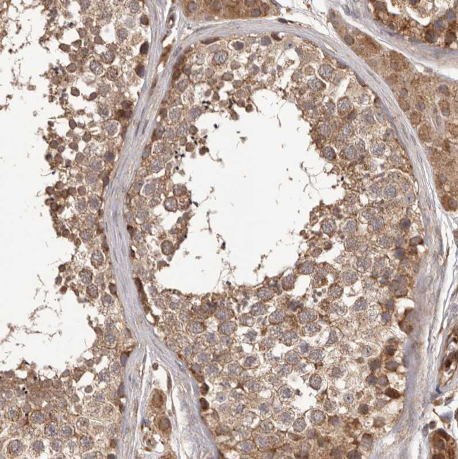 QRSL1 Antibody in Immunohistochemistry (Paraffin) (IHC (P))