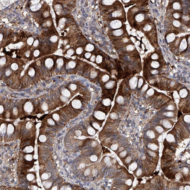 USP45 Antibody in Immunohistochemistry (Paraffin) (IHC (P))