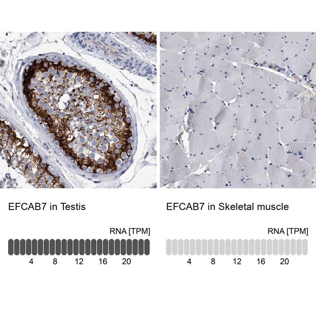 EFCAB7 Antibody in Immunohistochemistry (IHC)