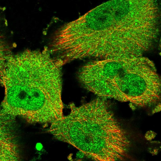 CHML Antibody in Immunocytochemistry (ICC/IF)