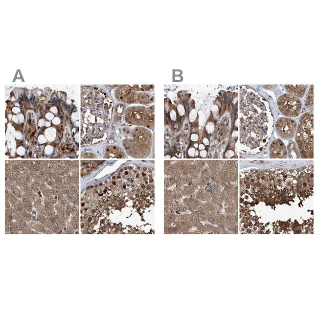 PSMB1 Antibody in Immunohistochemistry (IHC)