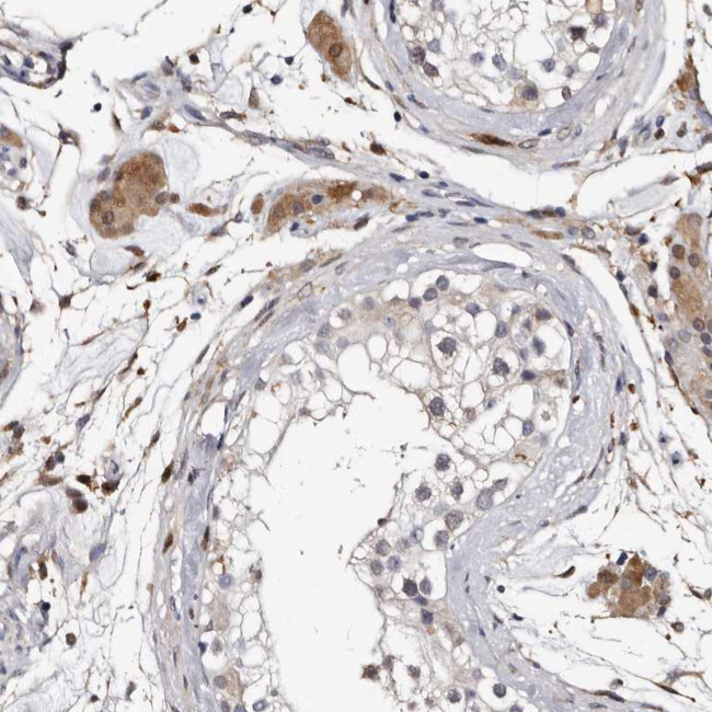 RCL Antibody in Immunohistochemistry (Paraffin) (IHC (P))