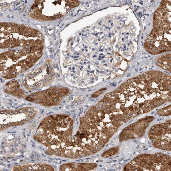 RCL Antibody in Immunohistochemistry (IHC)