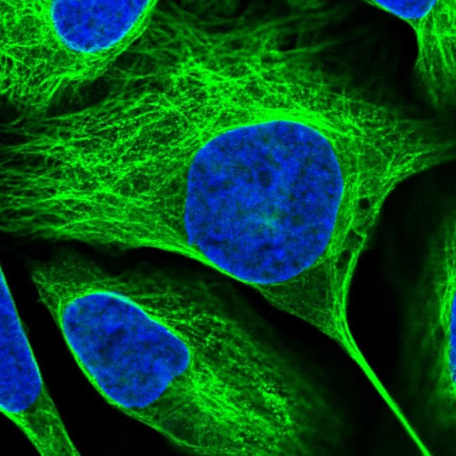 ALP Antibody in Immunocytochemistry (ICC/IF)