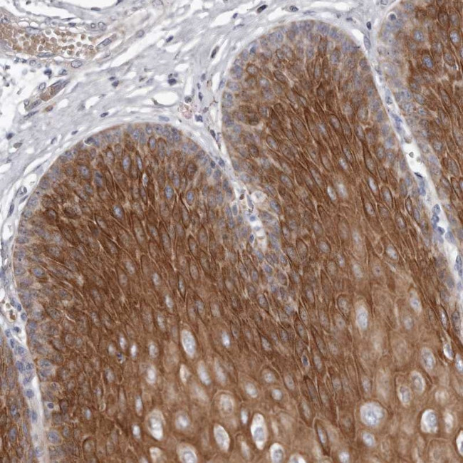 GPSN2 Antibody in Immunohistochemistry (Paraffin) (IHC (P))