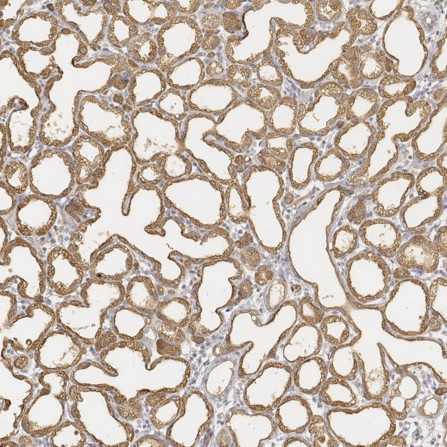 LALBA Antibody in Immunohistochemistry (Paraffin) (IHC (P))