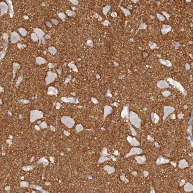 Tenascin R Antibody in Immunohistochemistry (Paraffin) (IHC (P))