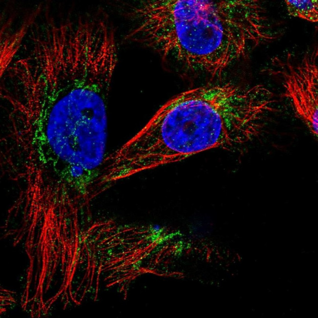 SLC25A20 Antibody in Immunocytochemistry (ICC/IF)