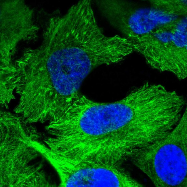 Plectin Antibody in Immunocytochemistry (ICC/IF)