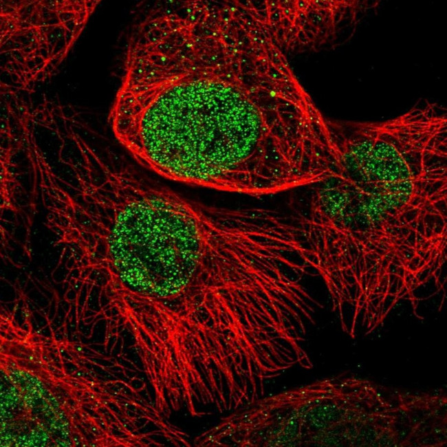 FTSJD2 Antibody in Immunocytochemistry (ICC/IF)