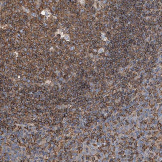 RSPO3 Antibody in Immunohistochemistry (IHC)