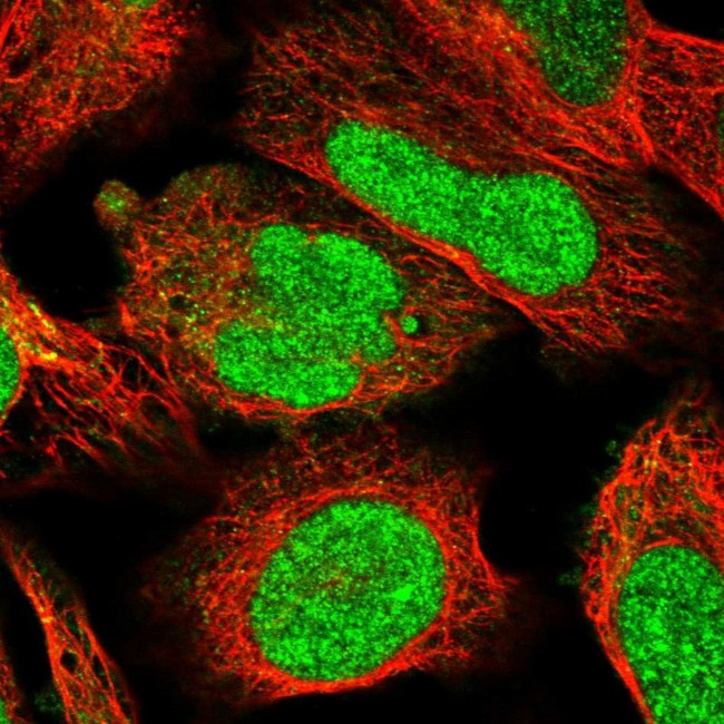 FTSJD2 Antibody in Immunocytochemistry (ICC/IF)