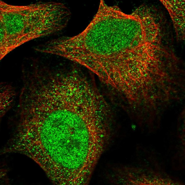 FTSJD2 Antibody in Immunocytochemistry (ICC/IF)