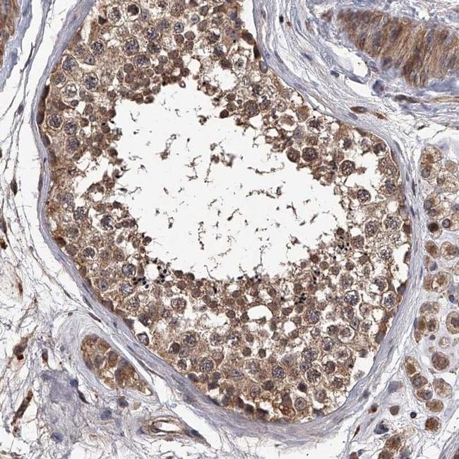 STK36 Antibody in Immunohistochemistry (IHC)