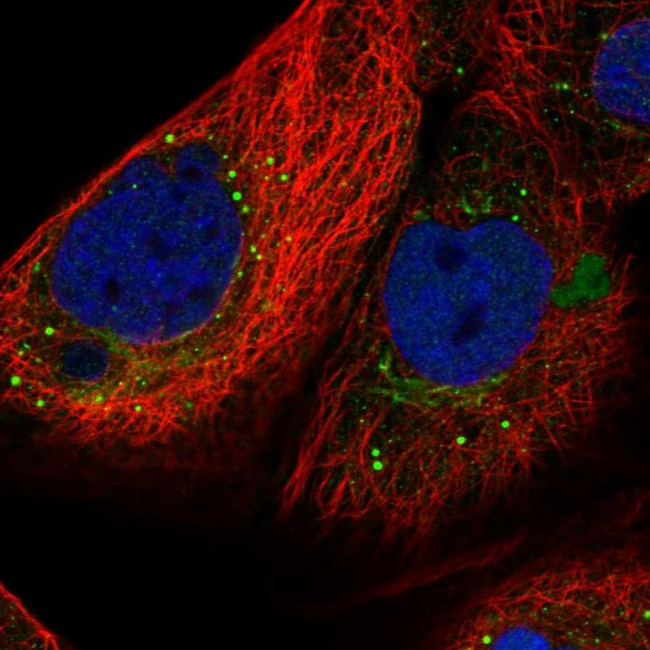 SMYD4 Antibody in Immunocytochemistry (ICC/IF)