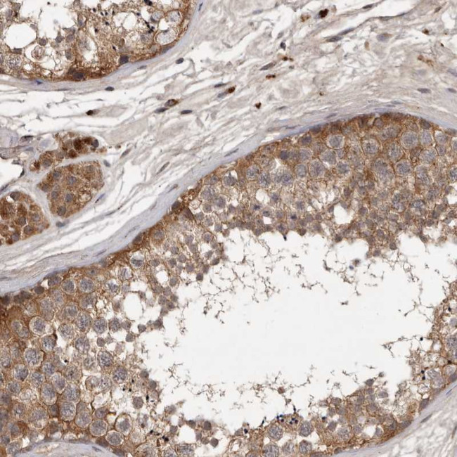 DNAJC28 Antibody in Immunohistochemistry (Paraffin) (IHC (P))