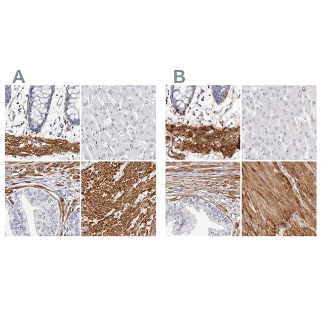 LMOD1 Antibody in Immunohistochemistry (IHC)