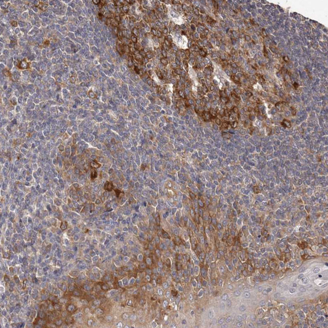 LTV1 Homolog Antibody in Immunohistochemistry (Paraffin) (IHC (P))