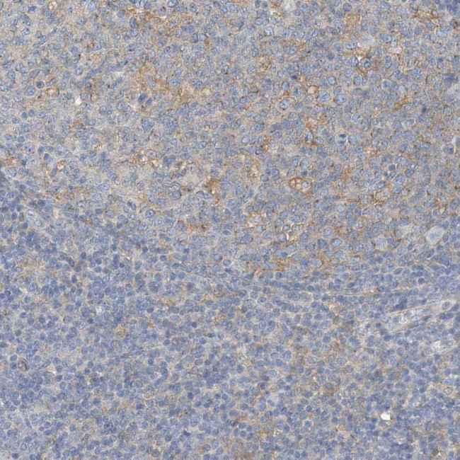 MICAL1 Antibody in Immunohistochemistry (Paraffin) (IHC (P))