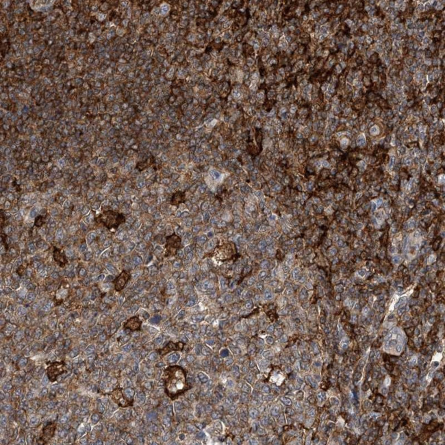 MICAL1 Antibody in Immunohistochemistry (Paraffin) (IHC (P))