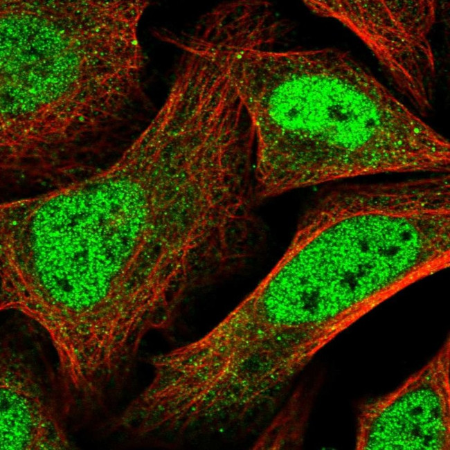 PDXK Antibody in Immunocytochemistry (ICC/IF)