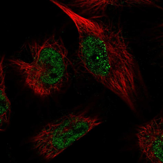 PDXK Antibody in Immunocytochemistry (ICC/IF)