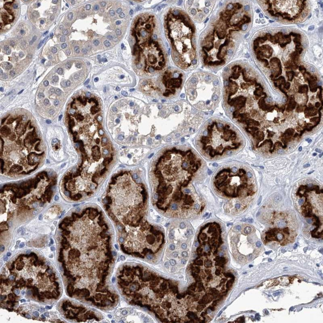 PDXK Antibody in Immunohistochemistry (Paraffin) (IHC (P))