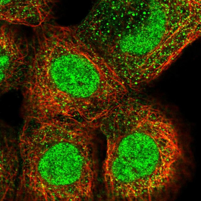 DST Antibody in Immunocytochemistry (ICC/IF)