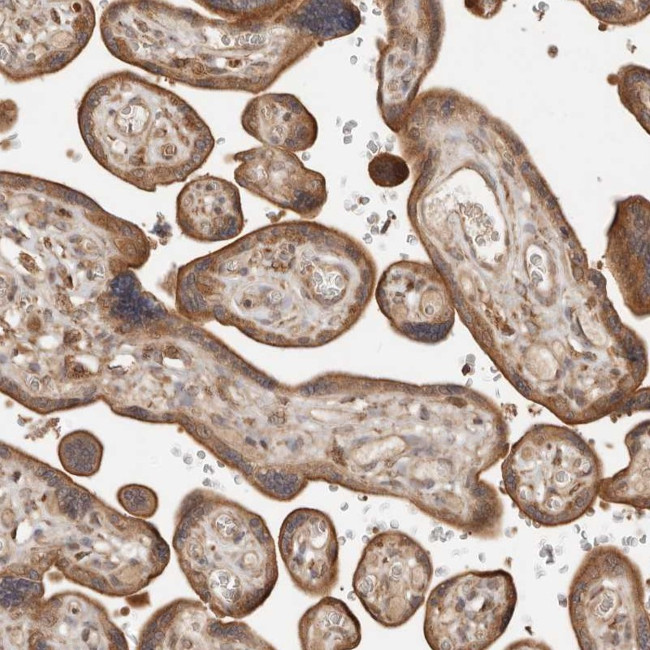 DACT2 Antibody in Immunohistochemistry (Paraffin) (IHC (P))