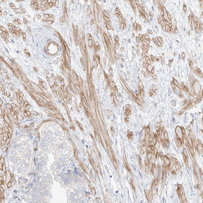 ITPKB Antibody in Immunohistochemistry (Paraffin) (IHC (P))