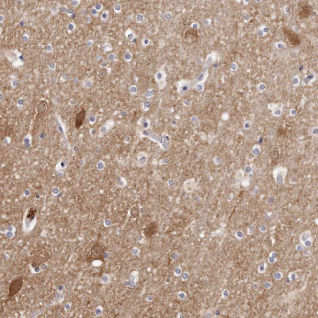 GDA Antibody in Immunohistochemistry (Paraffin) (IHC (P))