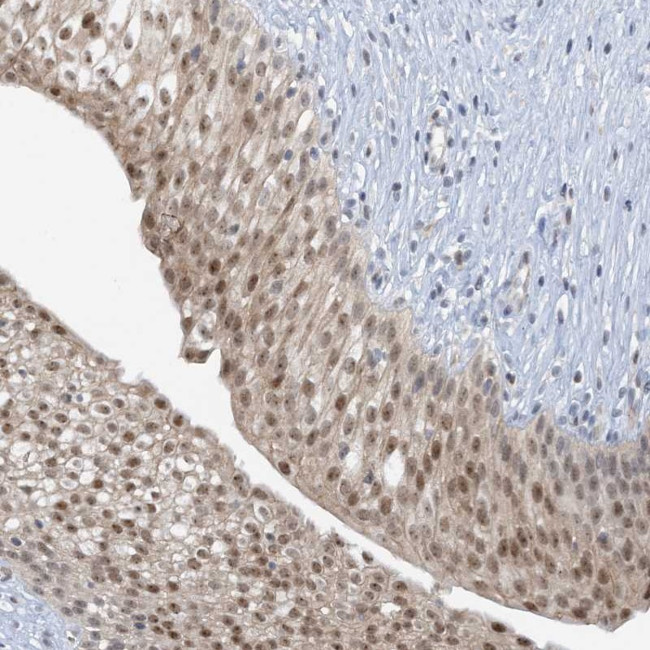 UBE2E1 Antibody in Immunohistochemistry (Paraffin) (IHC (P))