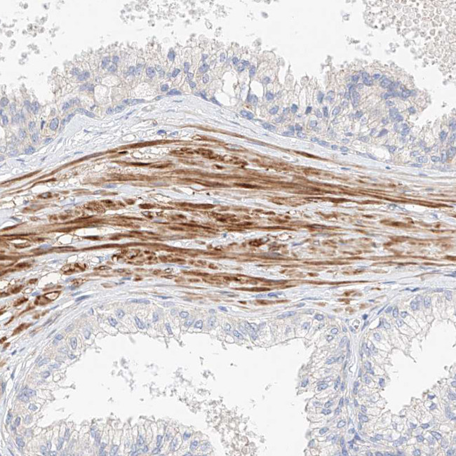 KCNH5 Antibody in Immunohistochemistry (Paraffin) (IHC (P))