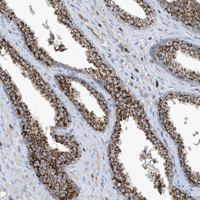 C1orf69 Antibody in Immunohistochemistry (Paraffin) (IHC (P))