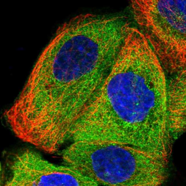 SMAP1 Antibody in Immunocytochemistry (ICC/IF)