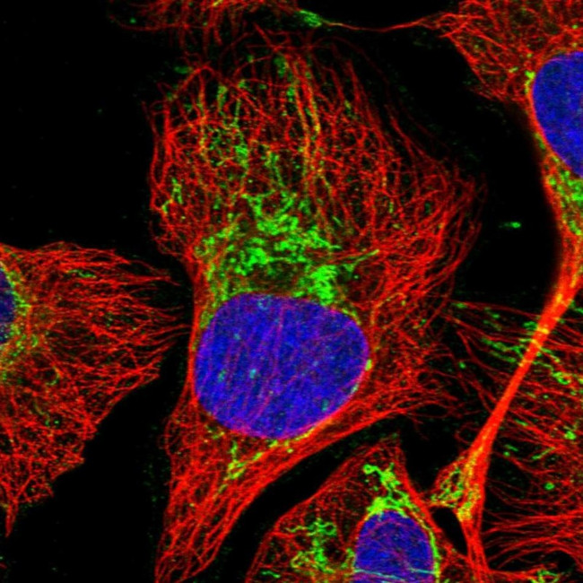 MRPL28 Antibody in Immunocytochemistry (ICC/IF)