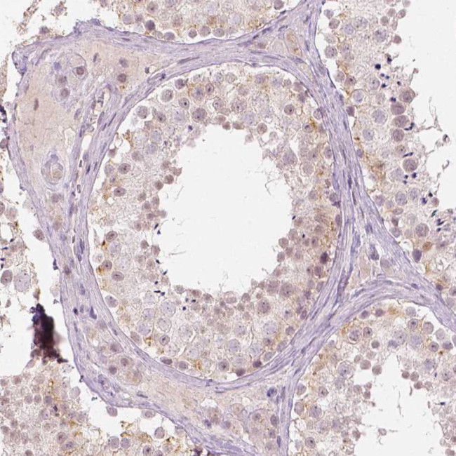 DLX6 Antibody in Immunohistochemistry (Paraffin) (IHC (P))