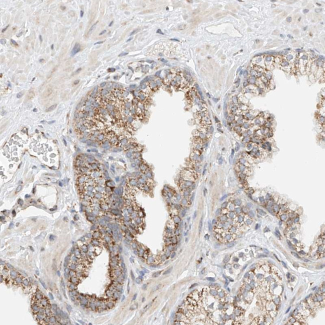 YIPF7 Antibody in Immunohistochemistry (Paraffin) (IHC (P))