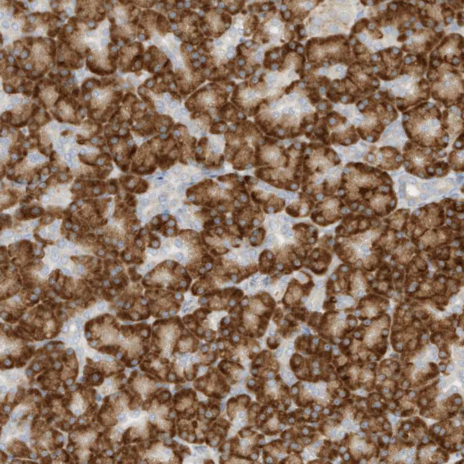 STT3A Antibody in Immunohistochemistry (Paraffin) (IHC (P))