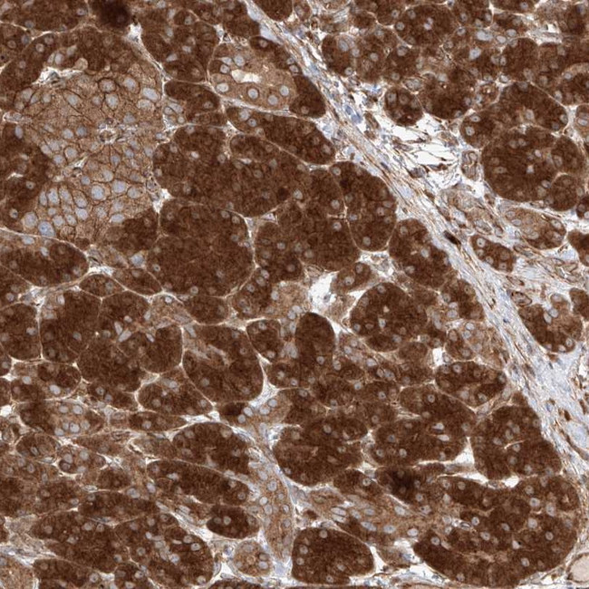 YKT6 Antibody in Immunohistochemistry (Paraffin) (IHC (P))