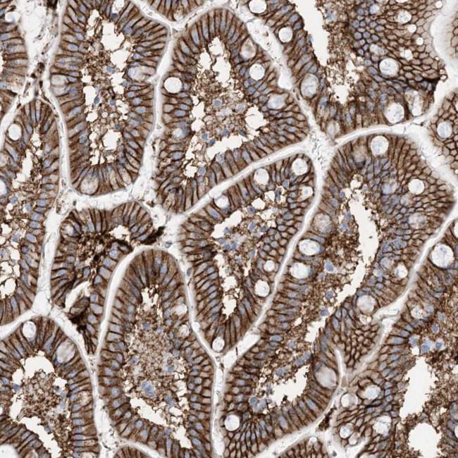 ATP11C Antibody in Immunohistochemistry (Paraffin) (IHC (P))