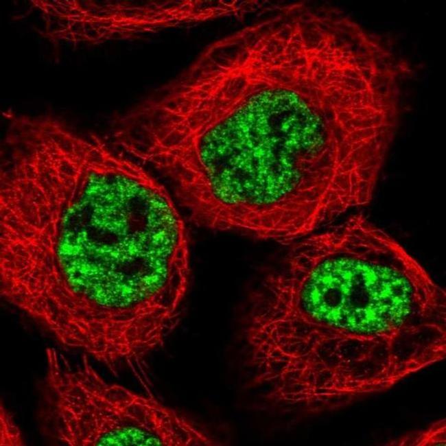 SARNP Antibody in Immunocytochemistry (ICC/IF)