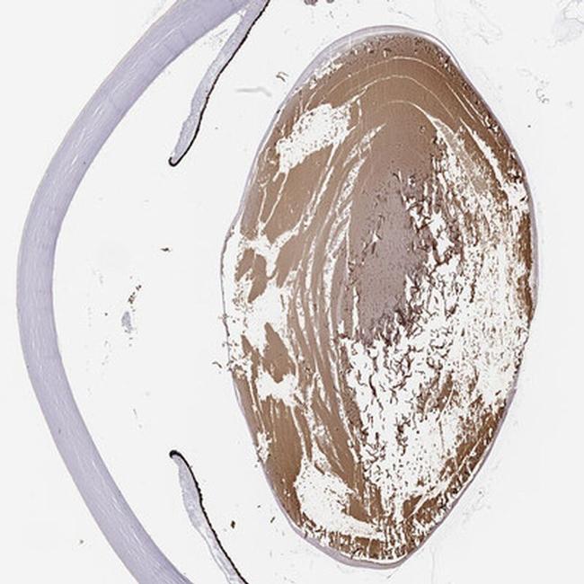 LGSN Antibody in Immunohistochemistry (IHC)